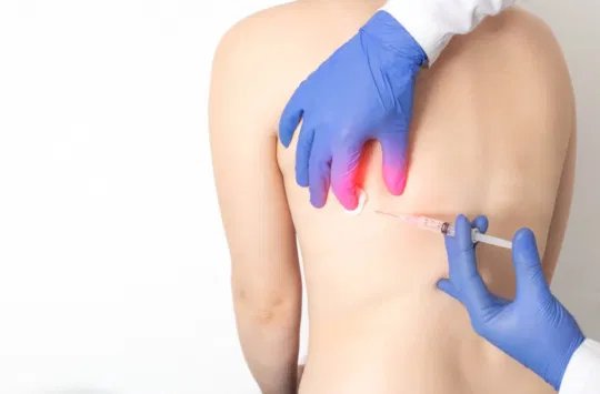 Intercostal Nerve Block